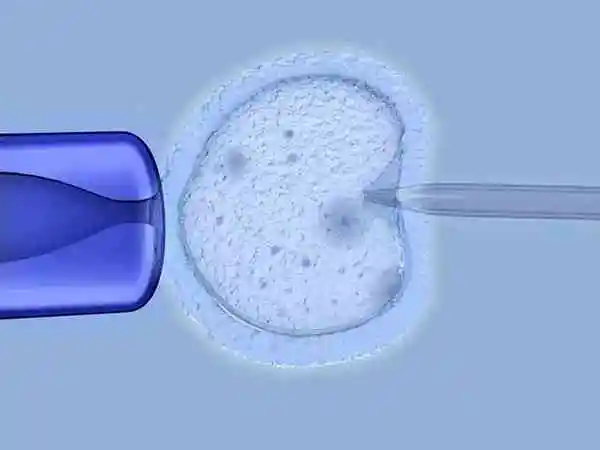 三代试管婴儿用什么促排方案(图1) 三代试管婴儿用什么促排方案(图1)