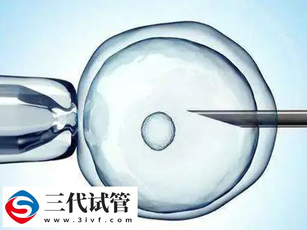 促排雌二醇10000多代表什么(图1)