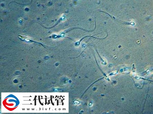 无精症的男人怎么生孩子(图1)