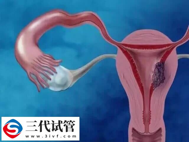 amh值偏低如何恢复(图1)