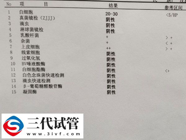 白带常规有哪些检查项目(图1)