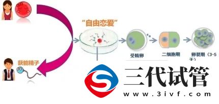 三代试管的那些事儿(图1)