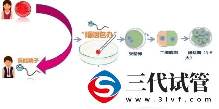 三代试管的那些事儿(图2)