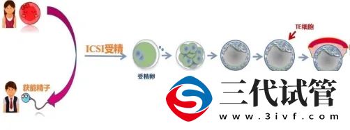 三代试管的那些事儿(图3)