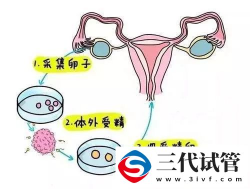 1代、2代、3代试管,有什么区别?哪个适合你?(图1) 1代、2代、3代试管,有什么区别?哪个适合你?(图1)