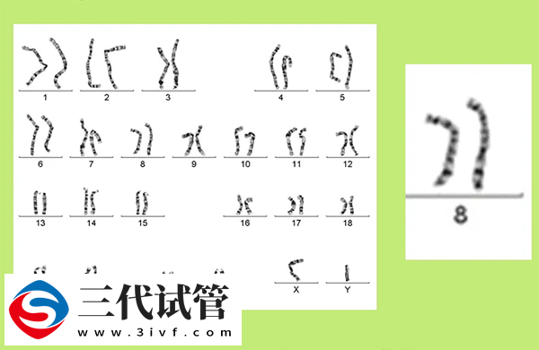 三代试管筛查为啥45天(图2) 三代试管筛查为啥45天(图2)
