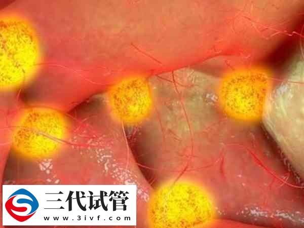 三代试管取卵10个能配成几个(图2)