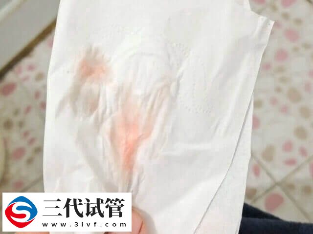 三代试管移植十六天出血多怎么办(图1) 三代试管移植十六天出血多怎么办(图1)