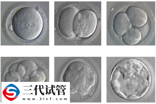 试管人工周期移植时间怎么定(图3)