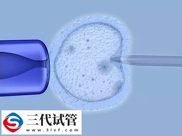 试管婴儿降调的含义(图2) 试管婴儿降调的含义(图2)