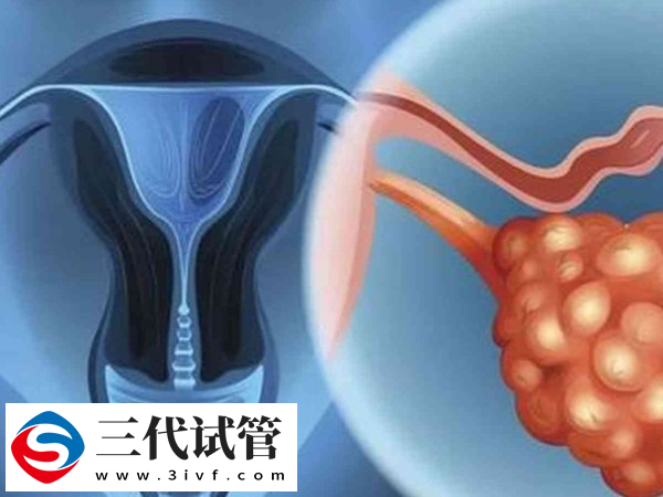 实施试管卵泡破了能不能取卵(图2) 实施试管卵泡破了能不能取卵(图2)