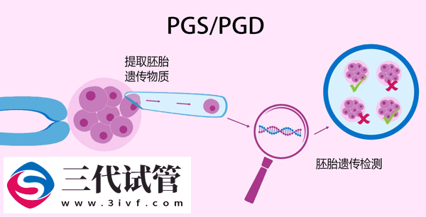 第三代试管婴儿流程、成功率、费用 可以筛查的疾病(图3)