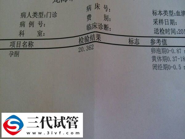 孕酮高鲜胚移植怎么样(图2) 孕酮高鲜胚移植怎么样(图2)