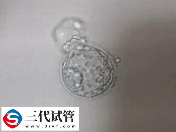 鲜胚移植成功率90%是不是真的(图1) 鲜胚移植成功率90%是不是真的(图1)