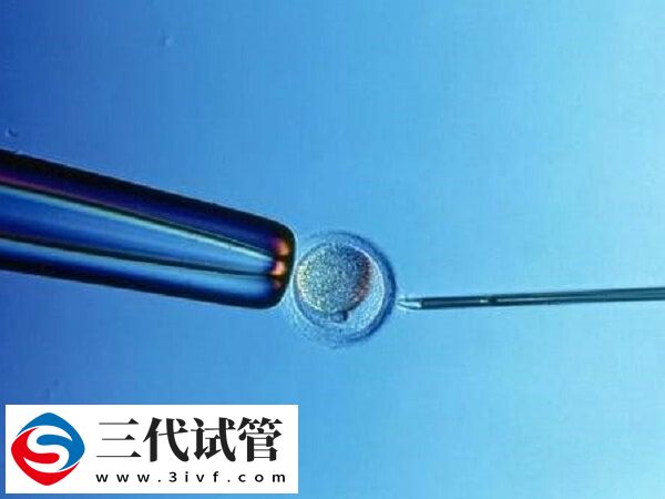 试管移植双胎着床后能不能减胎(图1)