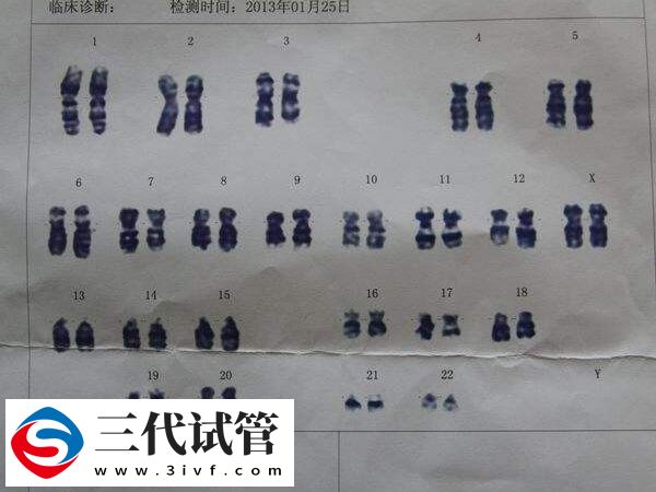 染色体47xxx可以做三代试管生孩子吗？(图1)