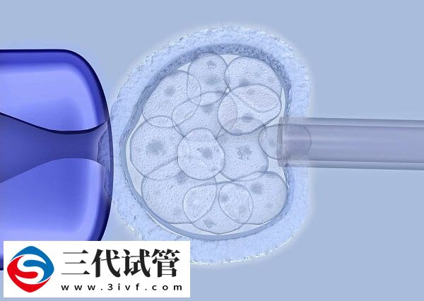 北京私人医院做三代试管包生女孩价格10万靠谱吗？(图1)