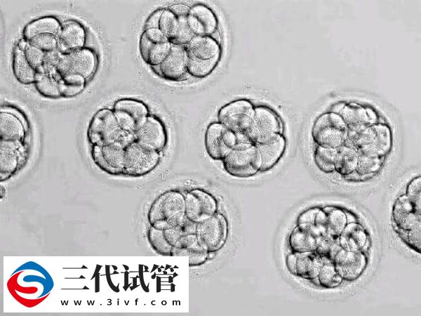 高龄试管一次移植几个(图1)