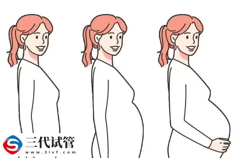 试管一定要剖腹产吗？(图1)