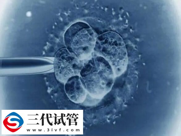 降调卵泡不均匀是怎么回事