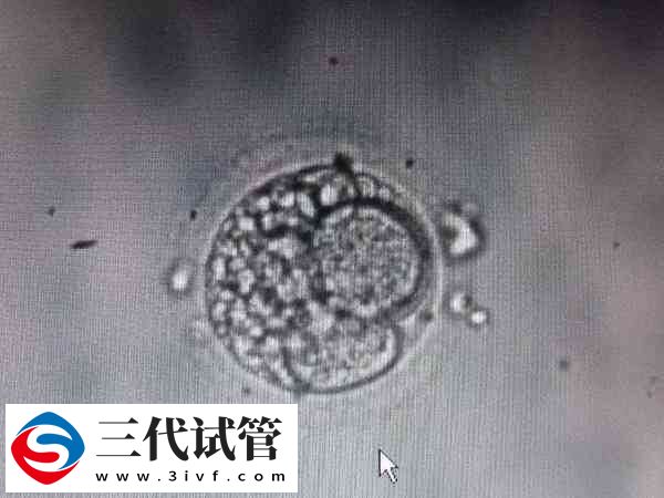 13细胞胚胎怎么样