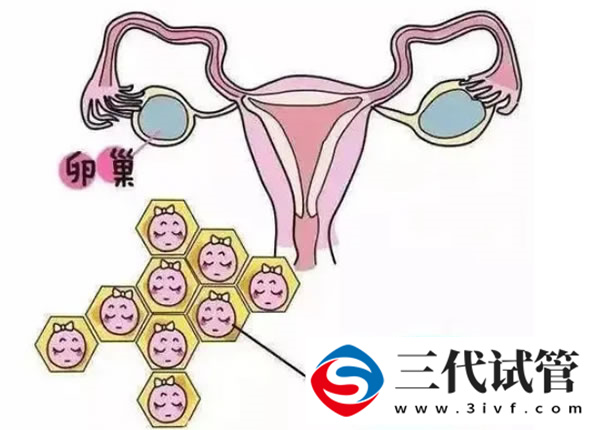 软骨发育不全是什么遗传病，三代试管能剔除这种遗传基因吗？(图4)