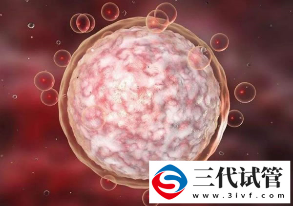 多基因遗传常见疾病可以做三代试管避免吗(图3)