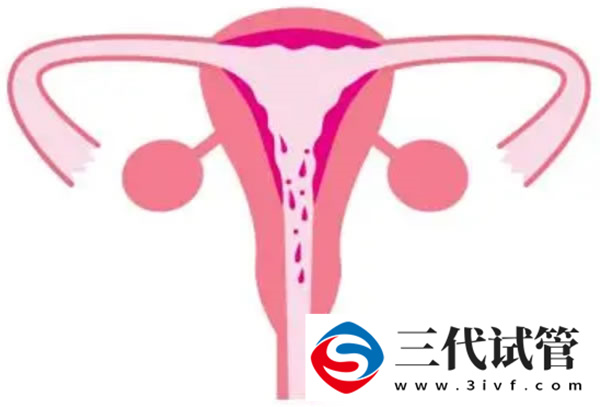 多囊试管长方案成功率高吗，多囊患者试管3种方案成功率解读(图1)